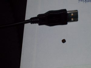 Pebble extracted from right thigh